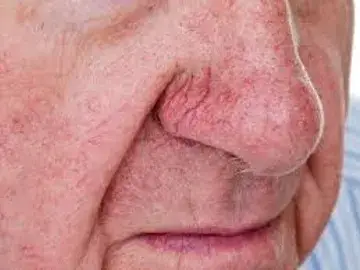 A close up of the face of an older man