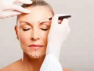 A woman is getting her face waxed by an esthetician.