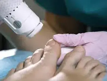 A person is getting their foot waxed